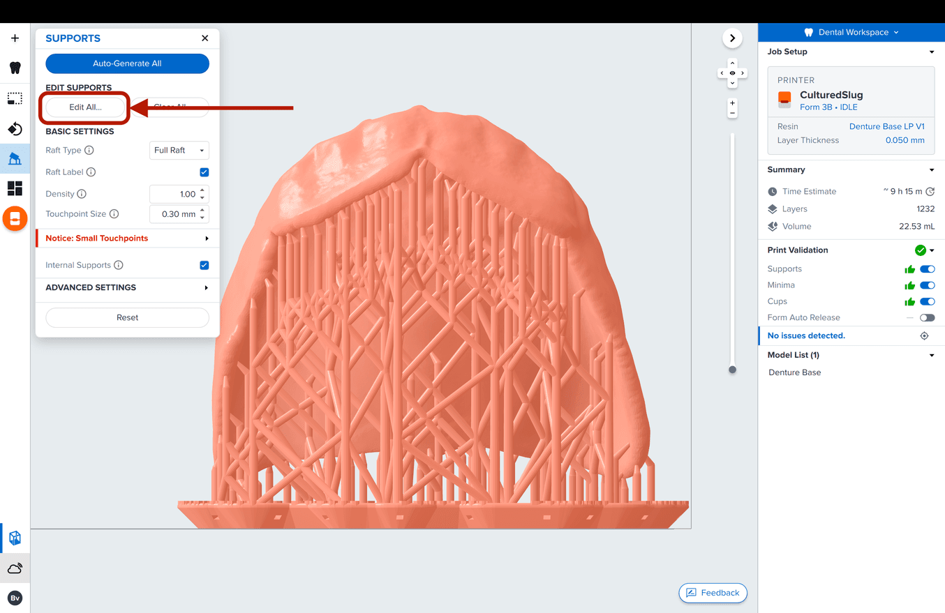 Denture base edit supports highlighted