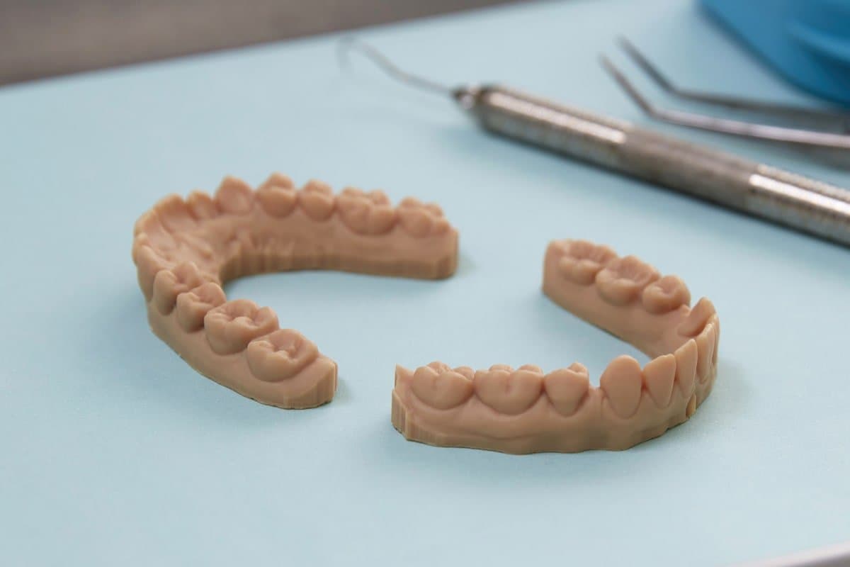 dental diagnostics model - 3d printed