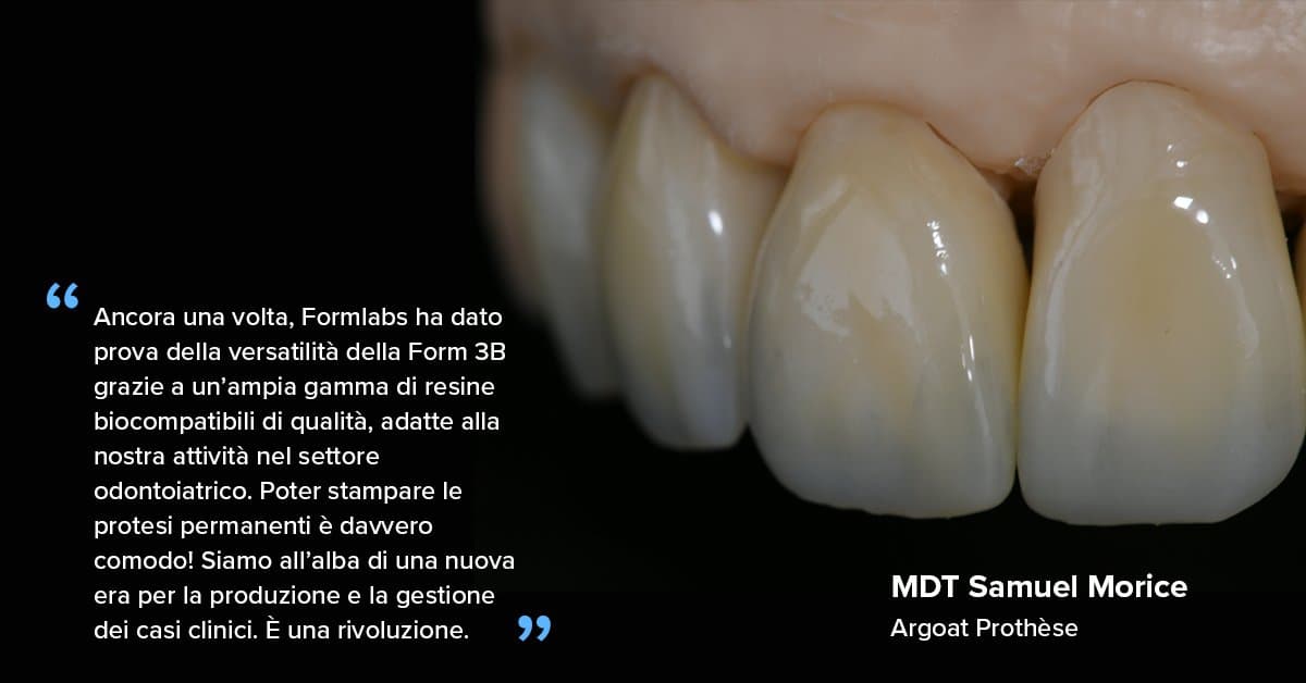 "Ancora una volta, Formlabs ha dato prova della versatilità della Form 3B grazie a un’ampia gamma di resine biocompatibili di qualità, adatte alla nostra attività nel settore odontoiatrico. Poter stampare le protesi permanenti è davvero comodo!"