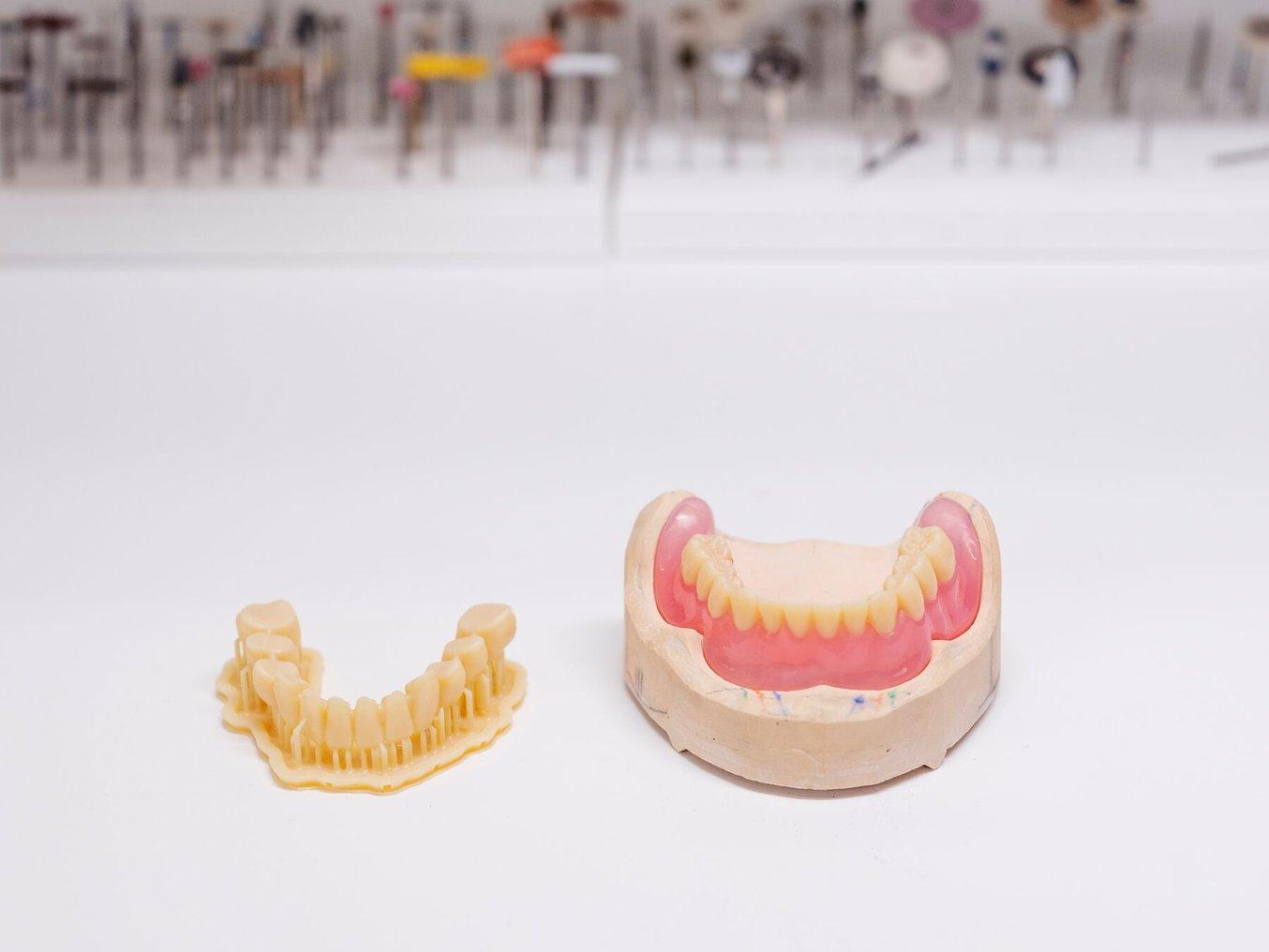 3D printed dentures teeth next to a full 3D printed mandibular denture