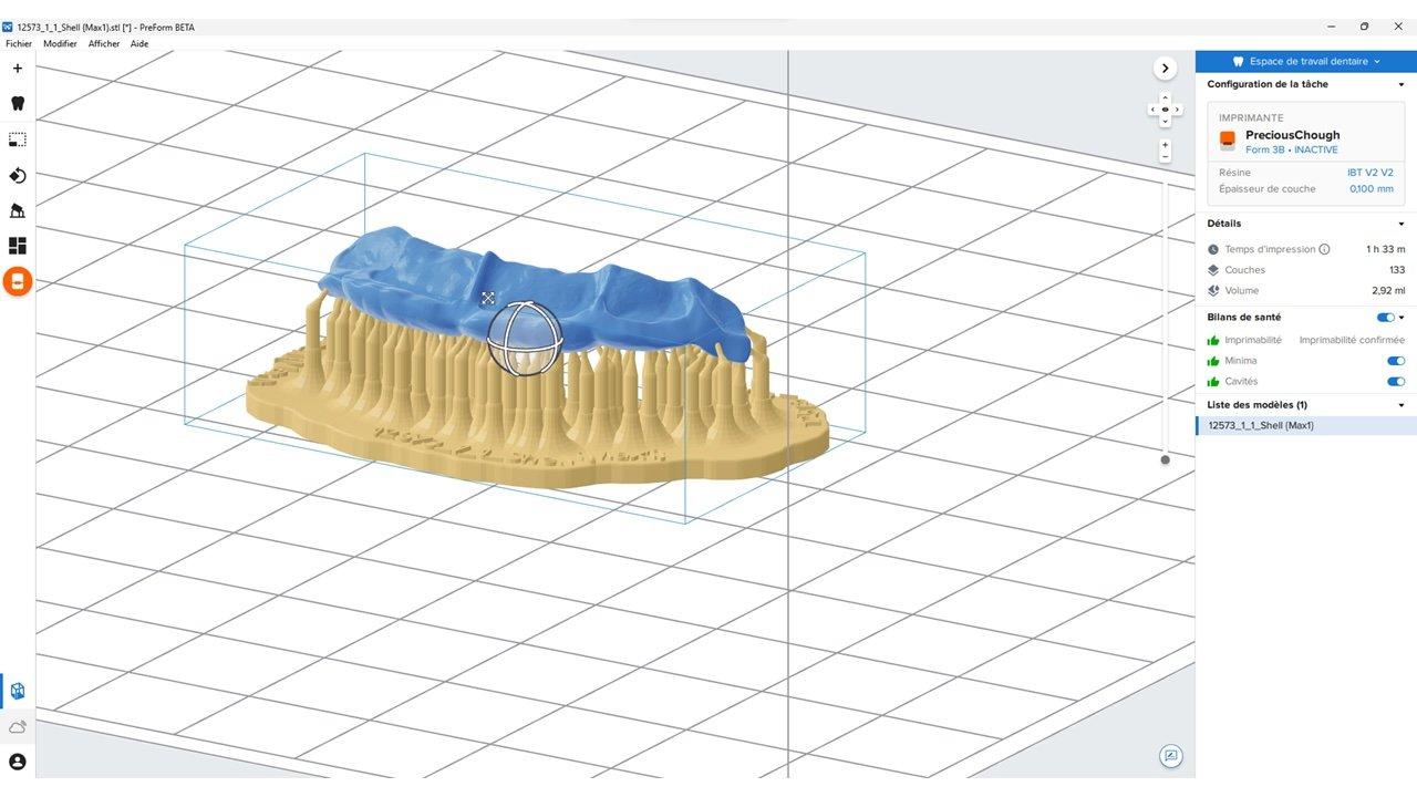 3D model of a direct composite guide ready for printing