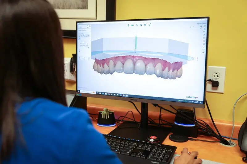 Dental 3D Printing
