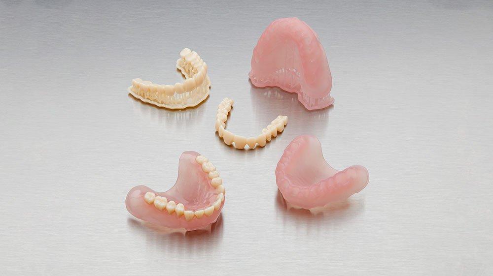 3D printed full dentures consist of different parts for the teeth and gingiva, printed separately and unified in post-processing.