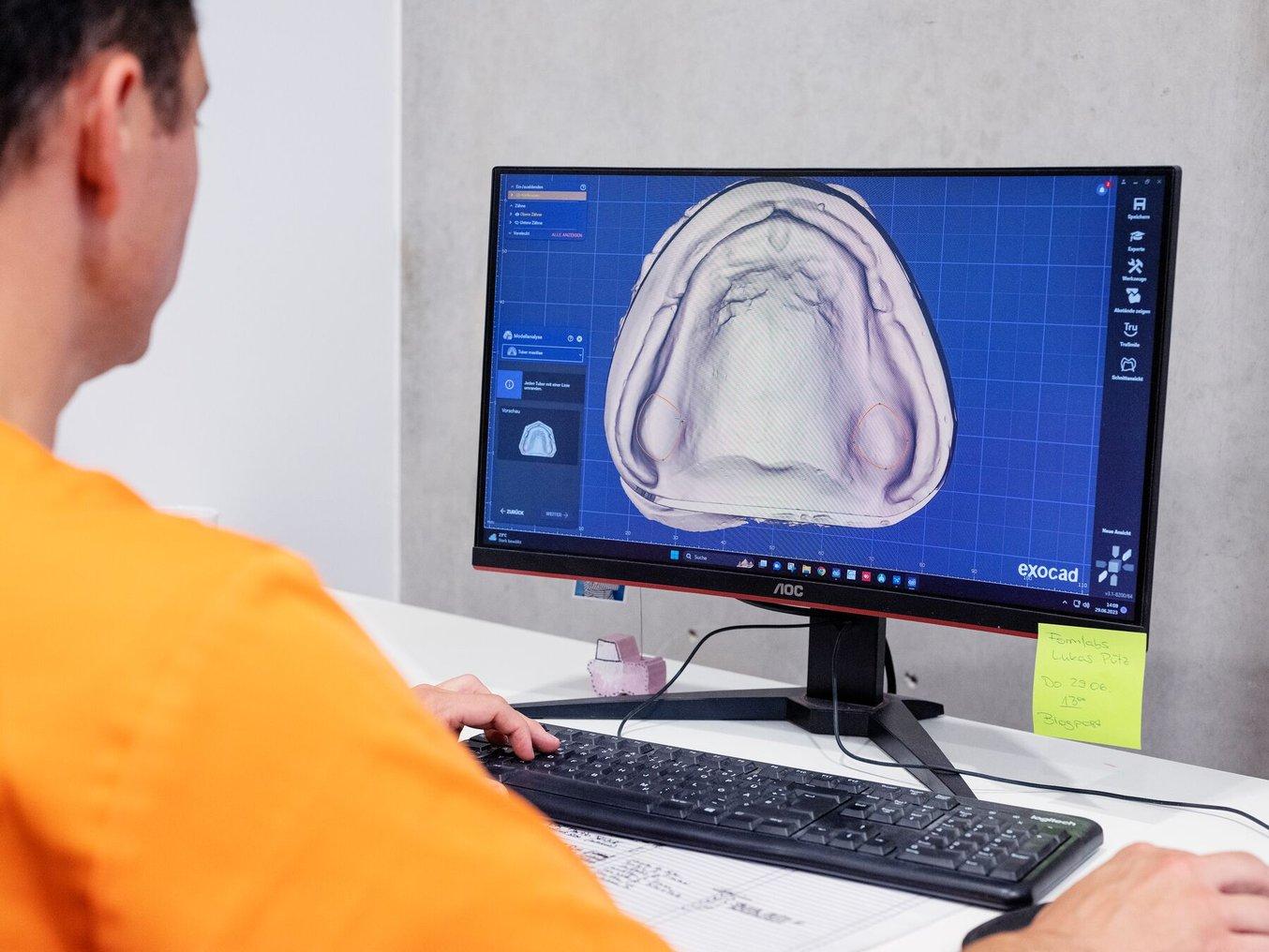 A dental technician designing a denture using CAD software