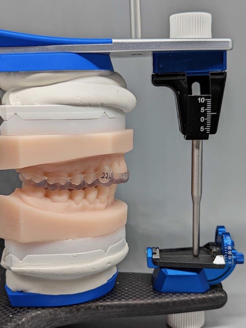 3d printed splint