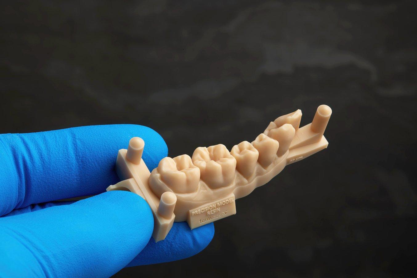 Modello di protesi stampato in 3D in marrone chiaro con la Precision Model Resin