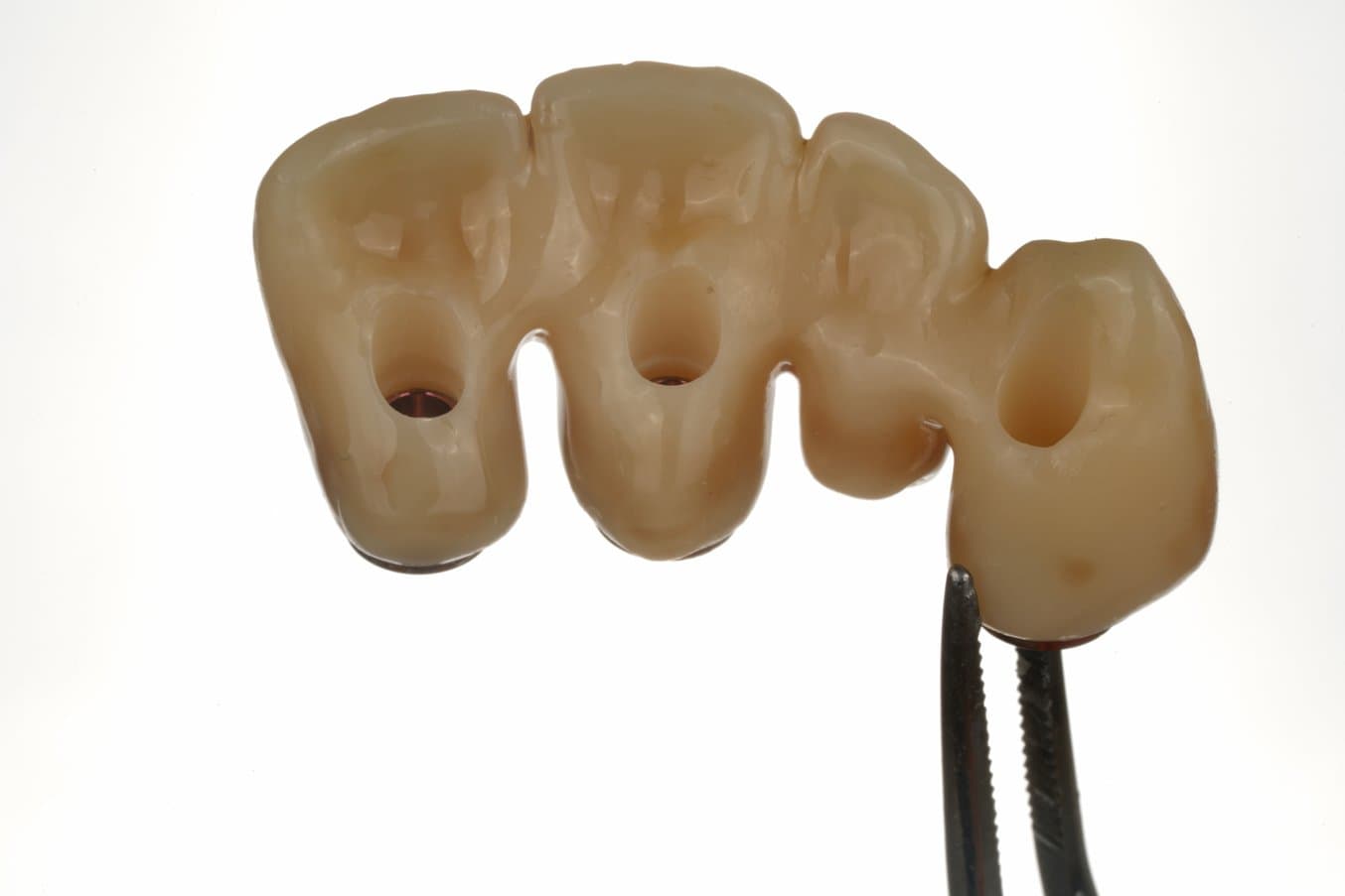 Four units 3D printed with BEGO™ VarseoSmileⓇ TriniQⓇ Resin