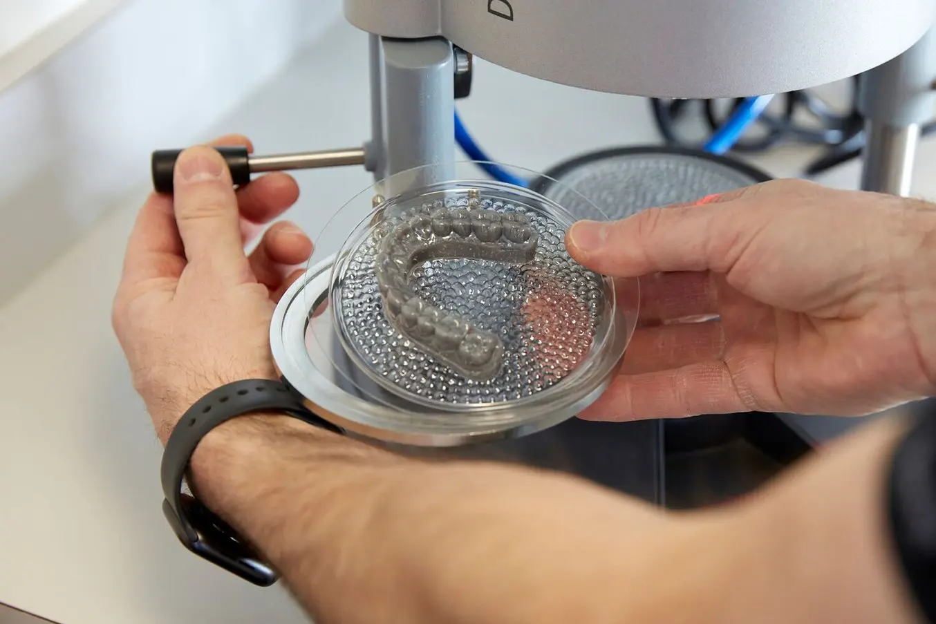 Thermoforming a clear aligner