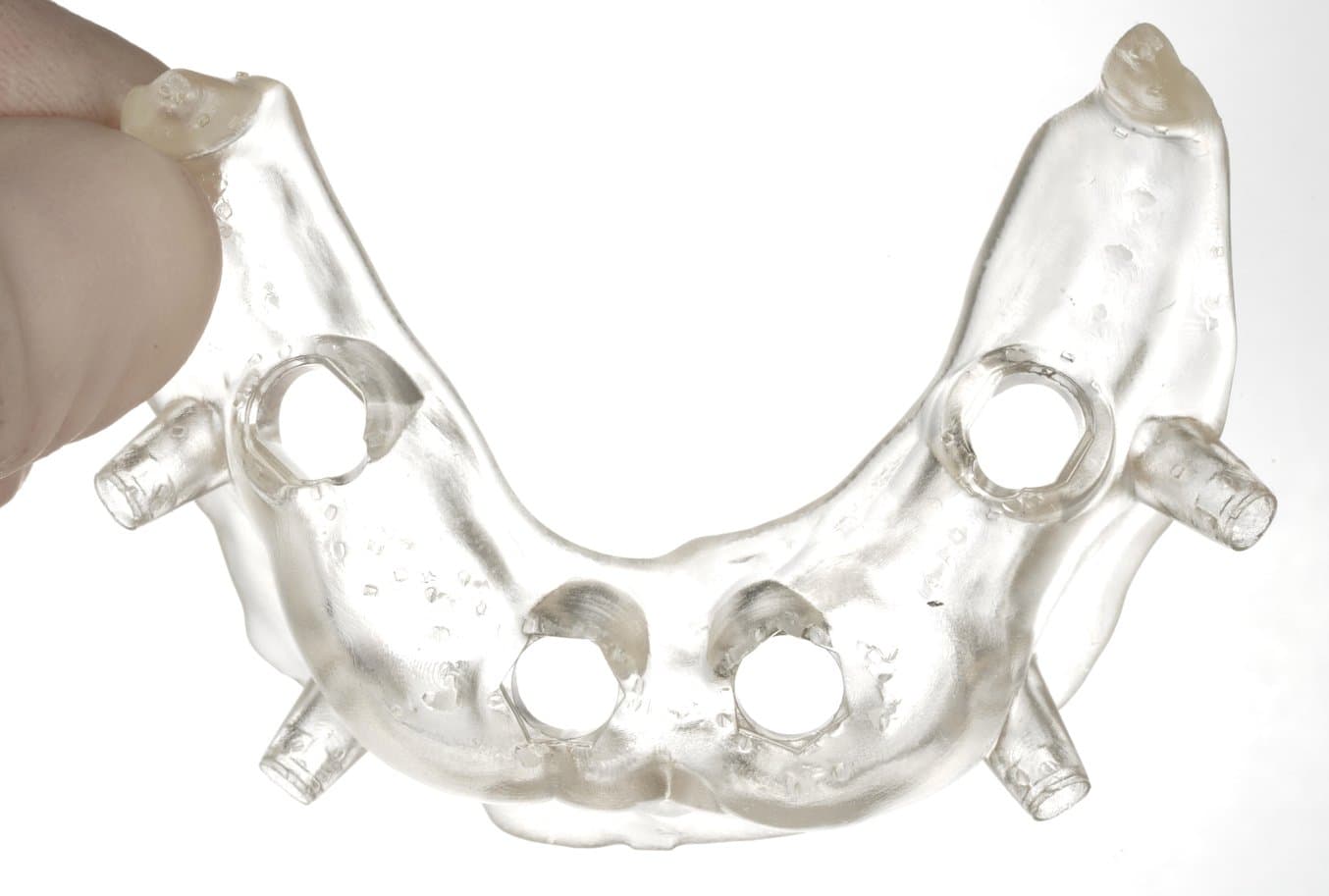 3D printed clay surgical guide without sleeves