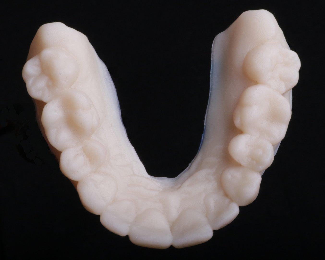 dental model 3d-printed with Formlabs Model Resin