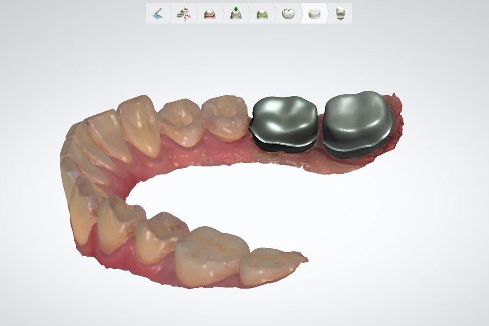 Castable Dental Design