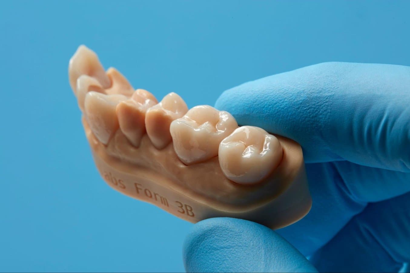 Unter Verwendung von Permanent Crown Resin kann der Formlabs 3D-Drucker permanente Einzelkronen, Inlays, Onlays und Veneers herstellen. Mit diesem fortschrittlichen Kunstharz erstellen Sie hochstabile Langzeitrestaurationen mit präziser Passung.