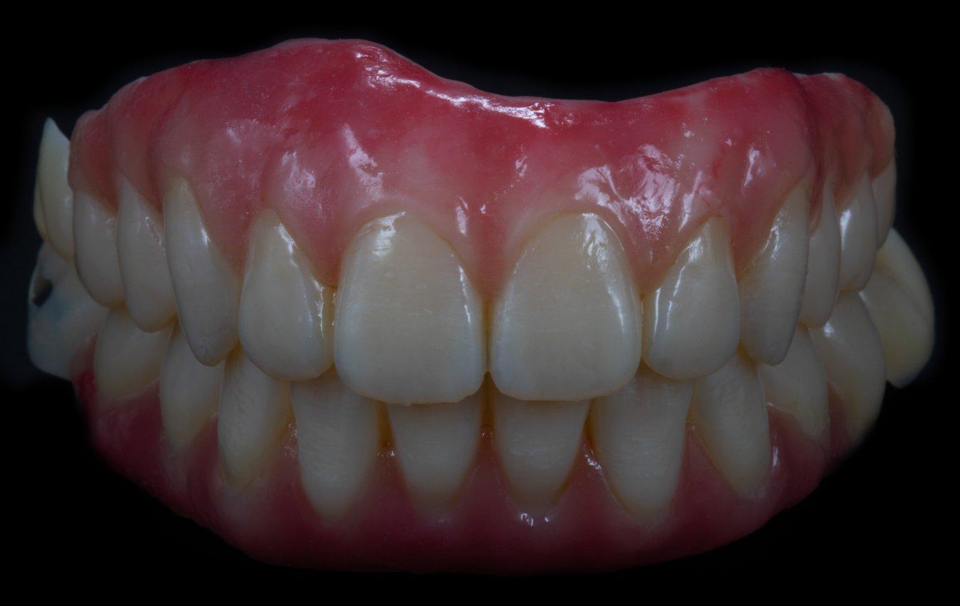 A finished 3D printed denture