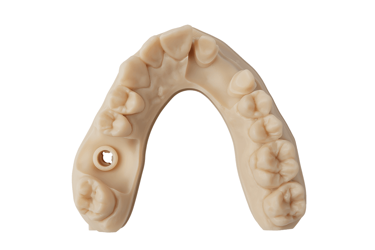 A restorative model printed in Precision Model Resin