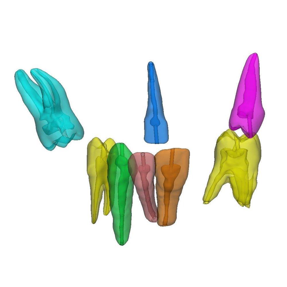 Digitale Zahnmodelle, aus CT-Bildern segmentiert.
