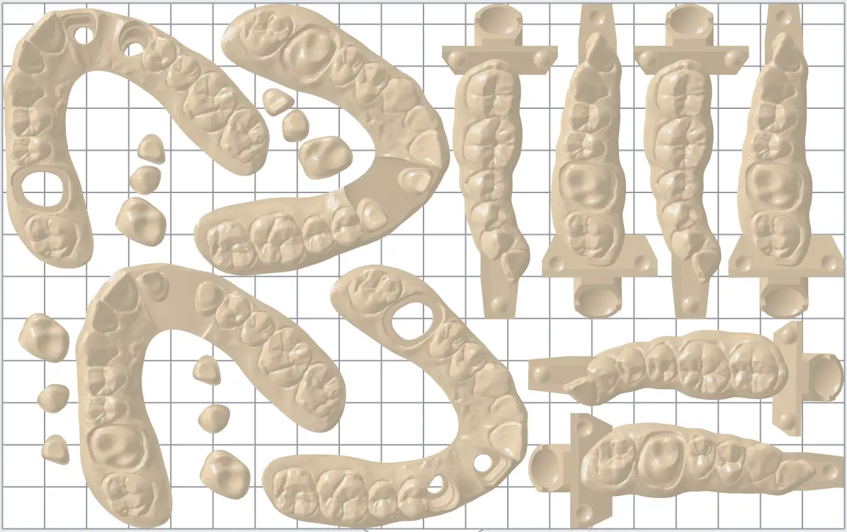 Restorative models on a build platform in PreForm