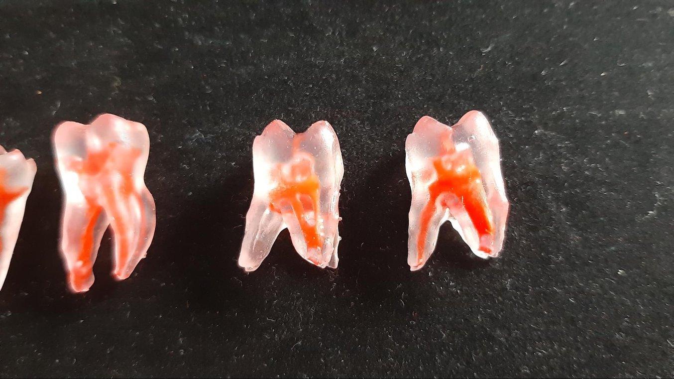 Einige der 3D-gedruckten und handbemalten Zahnmodelle (ein- und mehrwurzelig), die vom Team von Btech hergestellt wurden.