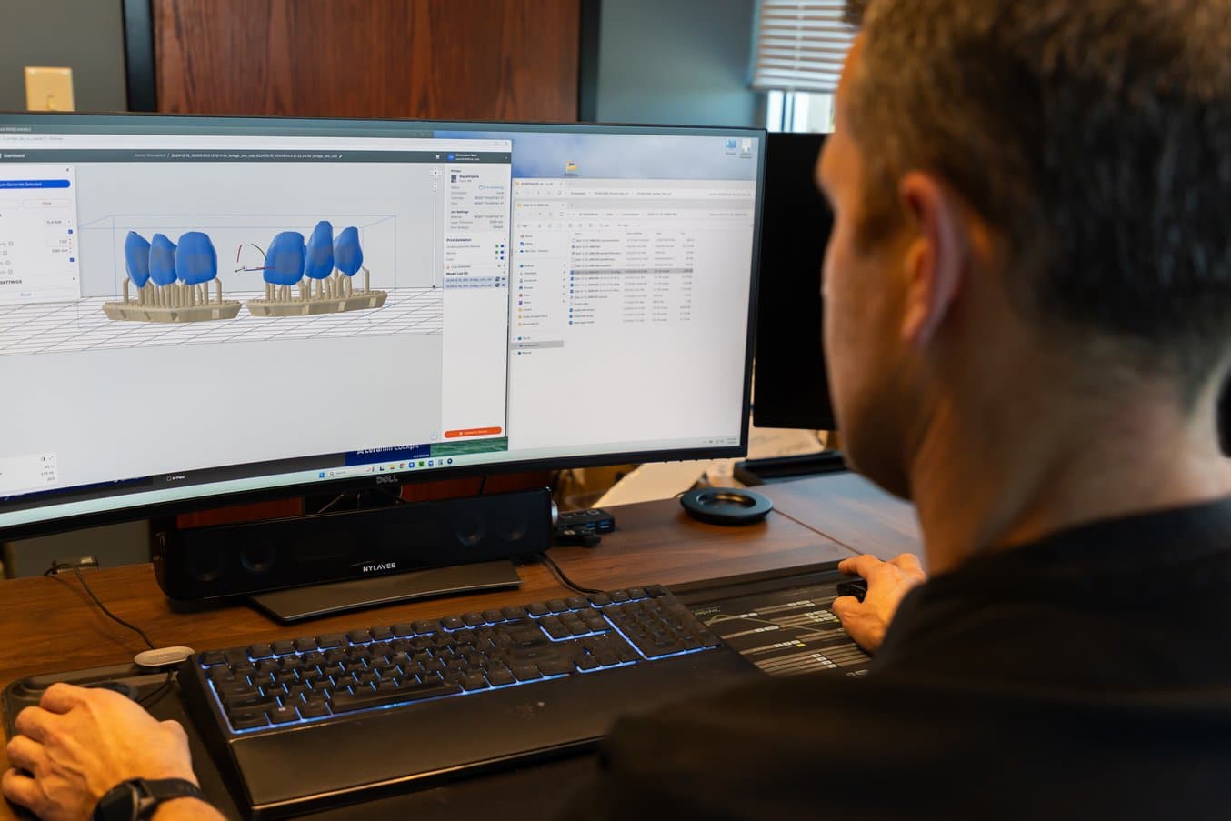 Dr. Baer looking at a computer screen showing restorations in PreForm Dental
