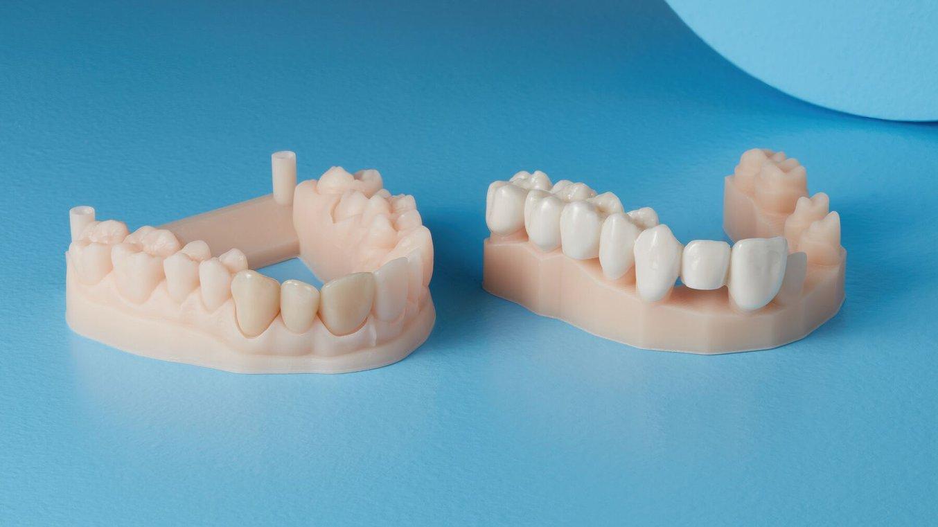 Two pairs of crowns printed in Temporary CB Resin sit on a blue table.